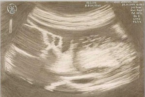 Artist: Ignacio (Spain)